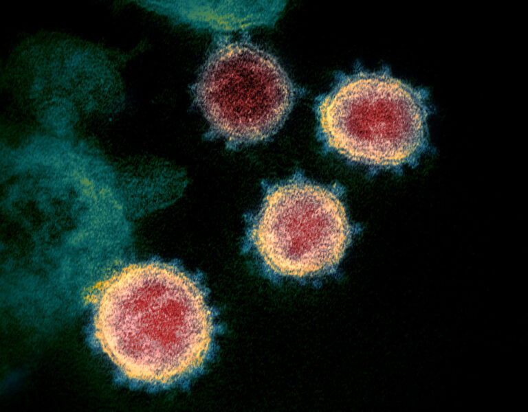 Coronavirus. Source Wikicommons